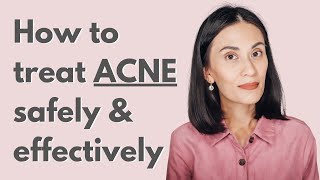 Safe and Effective Treatment for Mild to Moderate Acne  Dr Gaile RobredoVitas [upl. by Alios]