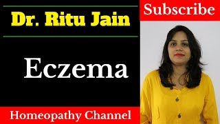 Eczema एक्जिमा Causes Symptoms amp Types  Atopic amp Seborrheic Dermatitis Symptoms Hindi Practo [upl. by Netloc185]