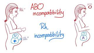 ABO incompatibility vs Rh incompatibility [upl. by Hilten649]