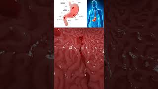 Ulcer in human 3d Animated Views shorts anatomy viralvideo meded ulcers [upl. by Bringhurst643]