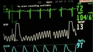 cardiac monitor [upl. by Kirre]