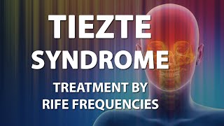 Tietze syndrome  RIFE Frequencies Treatment  Energy amp Quantum Medicine with Bioresonance [upl. by Marla]