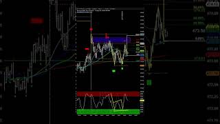 The Fibonacci Tool StockOptions DayTrading 📈 [upl. by Ixel]