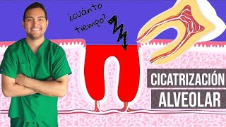 ¿Cómo es la extracción de la muela del juicio  Colgate® [upl. by Euqinahs310]