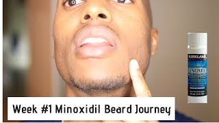 Minoxidil Beard Journey Week 1 [upl. by Carly]