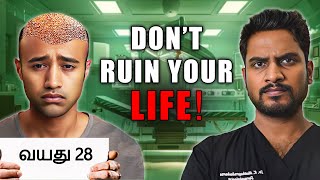 Why a Hair Transplant in Your 20s Could Be a Huge Mistake [upl. by Ttegdirb760]