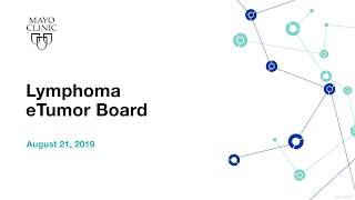 Mayo Clinic Lymphoma eTumor Board  Splenic marginal zone lymphoma with massive splenomegaly [upl. by Eisserc474]