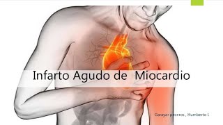 Infarto Agudo del Miocardio con Elevación del Segmento ST [upl. by Reywas209]