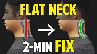 Fix Flat NeckCervical Kyphosis｜Neck Correction｜Balancing Exercises [upl. by Avril926]