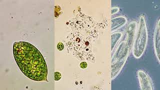 Microorganism moving methods  Flagella Pseudopodia and Cilia [upl. by Kcirdef]