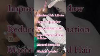 BOOST YOUR HAIR GROWTH WITH HAIR EXOSOMES hermosaclinique haircut youthfulglow baldhead hair [upl. by Janiuszck549]