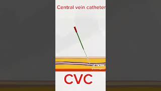 Central Veins Catheter ❤️ medicineuse cardiacnurse nursing anatomy [upl. by Tecil]