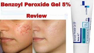 Benzoyl Peroxide Gel For Acne Treatment Review In Hindi 2019 [upl. by Dusen]