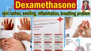 Dexona tablet  किस काम आती है  Dexamethasone tablets ip 05 mg uses in hindi [upl. by Buffy513]