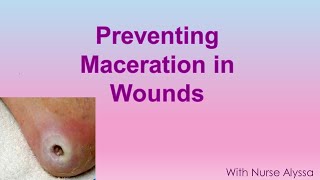 Preventing Maceration in wounds [upl. by Sadoff]