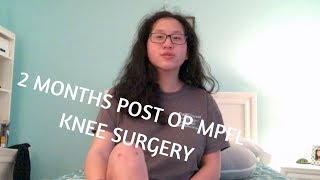 2 Months Post Op MPFL Reconstruction Surgery [upl. by Nichols]