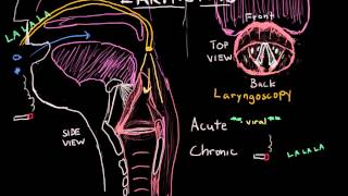 Laryngitis Diagnosis Treatment and Prevention [upl. by Ettevad]