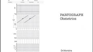 How to read a PARTOGRAPH  Obstetrics [upl. by Jamila]