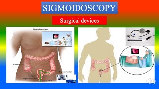 SIGMOIDOSCOPY Definition  parts uses  Precautions How to use   Surgical Devices [upl. by Anialahs192]