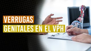 Verrugas genital y Virus del Papiloma Humano  ¿Qué son ¿Cómo tratarlas [upl. by Palmer23]