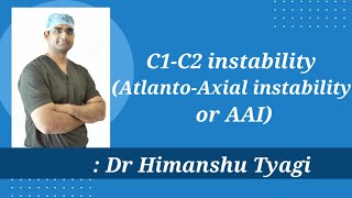 C1C2 instability AtlantoAxial instability or AAI  Causes symptoms and Treatment [upl. by Ayihsa]