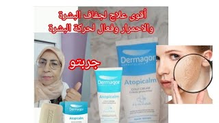 Dermagor Atopicalm كريم فعال👌يخلي وجهكبلارة مجربلعلاج التهيج والتشققاتواقي شمسي الحساسية [upl. by Anastasius]