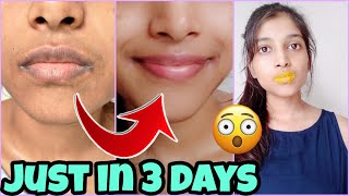 How I get rid of Pigmented lips 👄 REAL LIP CARE ROUTINE changes my lip colour [upl. by Rosenkrantz]