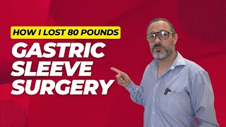 Eduardos gastric sleeve surgery anniversary [upl. by Merth721]