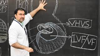 Development of Interventricular septum 2 [upl. by Aneekal]