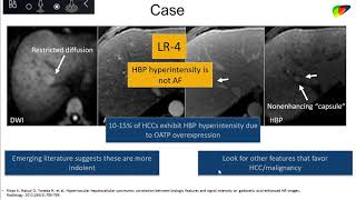 47Liver malignancy masquerading as benignancy  Part 2QampA  By Dr William Masch [upl. by Towroy]