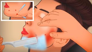 ASMR Shaving and Ingrown Hair Removal Animation Tingle Sound [upl. by Aundrea]