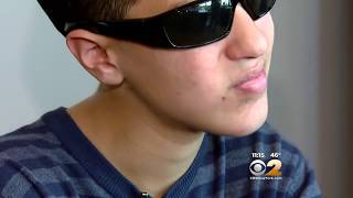 Vape Pen Explodes In Teen’s Face [upl. by Mable]