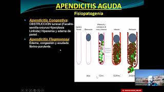 Cirugia en Pediatria [upl. by Myrlene]