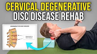 4 Exercises for Cervical Degenerative Disc Disease [upl. by Nilok]