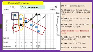 Analisando  um partograma partograma [upl. by Erialc577]