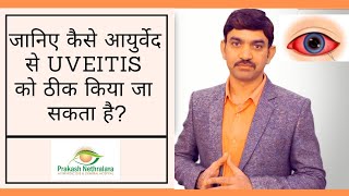 Uveitis Treatment in Ayurveda  Causes Symptoms of Uveitis  Prakash Nethralaya [upl. by Omrelliug]