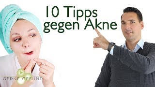 Was hilft gegen Akne 10 Tipps die wirklich funktionieren  Gerne Gesund [upl. by Adnohsat]