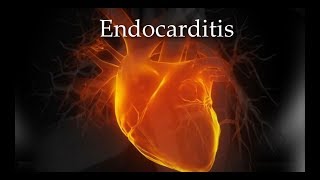 Infective Endocarditis  Animation  Mind mapping risk factor physical exam diagnosis treatment [upl. by Radloff627]