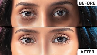 Remove Dark Circles Permanently FAST  Natural Home Remedies [upl. by Ash]