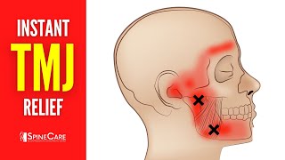 How to Relieve TMJ Pain at Home  30 SECOND RELIEF [upl. by Lynden]