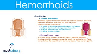 Hemorrhoids  causestypesclinical featuresdiagnosis and treatment [upl. by Mya]