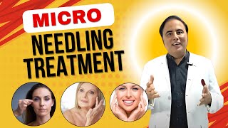 Microneedling Treatment Procedure Everything You Need to Know [upl. by Chan]