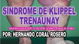 SINDROME DE KLIPPEL TRENAUNAY  MANCHA DE COLOR VINO EN LA PIEL [upl. by Rede]