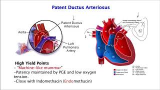 Patent Ductus Arteriosus [upl. by Dacia]