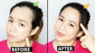 How To Naturally Grow Back Thinning Hairline amp Cover up Receding HairlineBeautyklove [upl. by Eidarb]