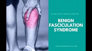 Benign Fasciculation Syndrome Symptoms and Causes  Diagnosis  Treatment  Prevention [upl. by Esekram]