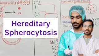 Hereditary Spherocytosis  Pathogenesis  Clinical Features  Lab Diagnosis  Treatment [upl. by Chlores]