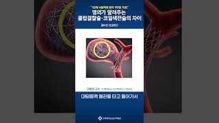 1분 건강백서 명의가 알려주는 클립결찰술·코일색전술의 차이│일산백병원 신경외과 구해원 교수 [upl. by Schwejda953]