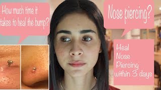 Nose Piercing Aftercare  Nose Pin or Nose Ring  Quick Heal [upl. by Eellek610]