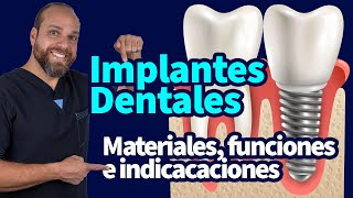 ImplantesDentales materiales funciones e indicacaciones [upl. by Cutlor]